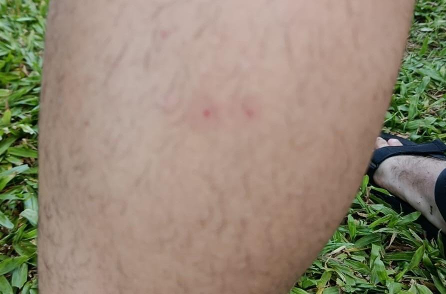 Homem é socorrido após possível picada de cobra em trilha na Costa da Lagoa em Florianópolis 