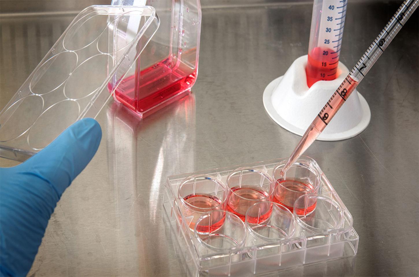 Terapia experimental com células-tronco do nariz pode ser caminho para tratar lesão na medula