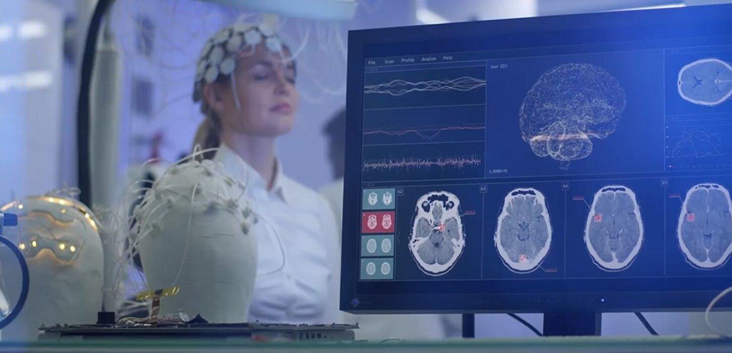 Os dados do seu cérebro podem ser usados ​​contra você? A ONU pede limites à neurotecnologia.