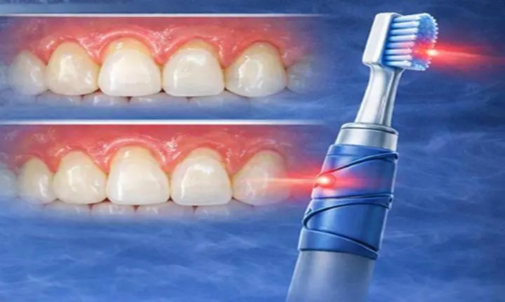 Odontólogos da Marinha desenvolvem escova dental inovadora para evitar danos gengivais e dentários